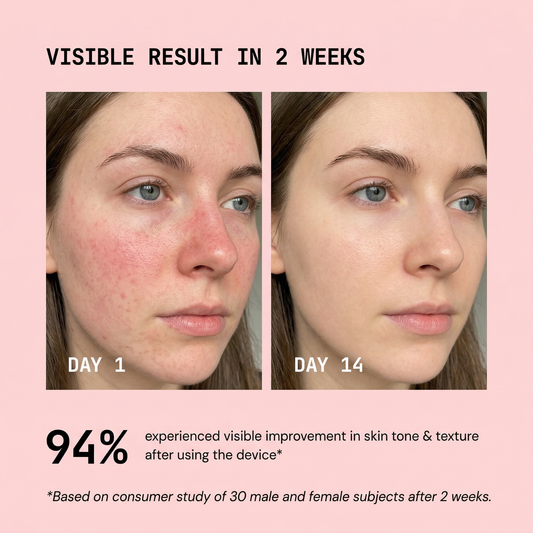 Mieyaskin Pro Red Light Therapy Face LED Device