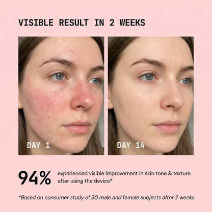Mieyaskin Pro Red Light Therapy Face LED Device - Duo Pack